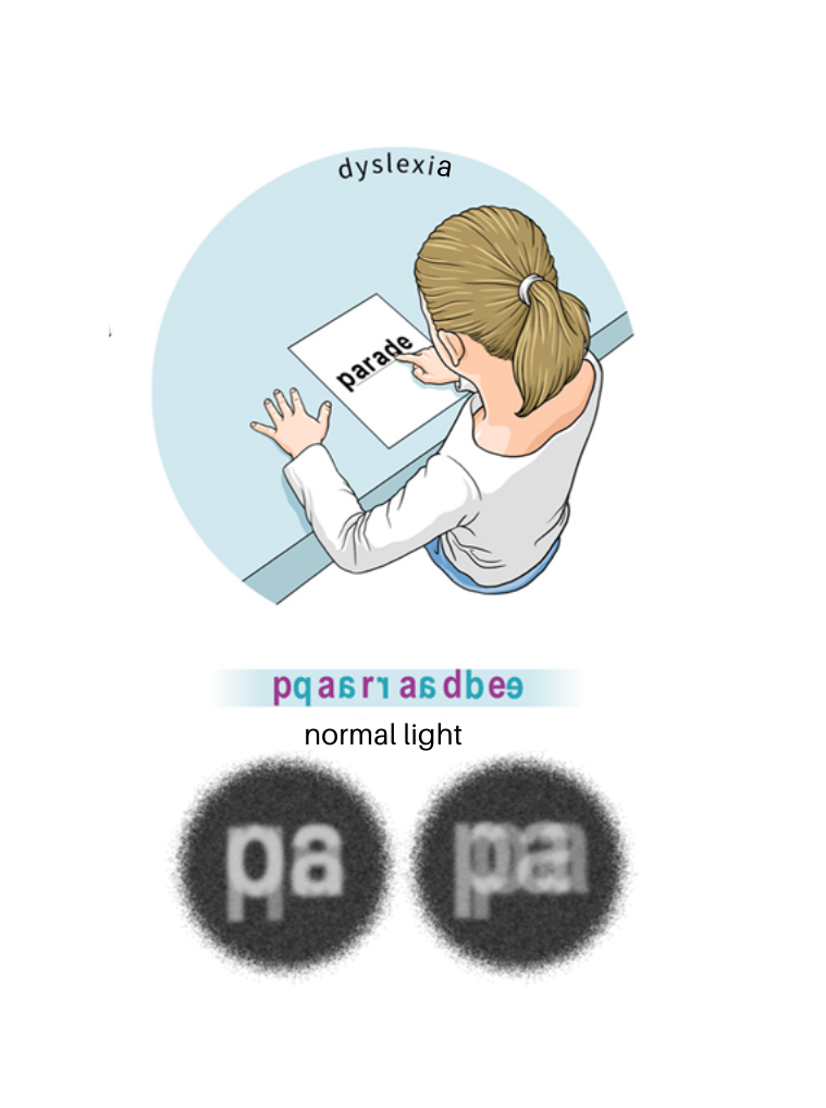 dyslexia)